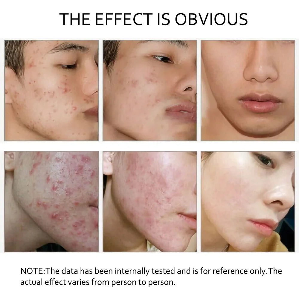 Retinol Serum Anti Wrinkle - Image 3