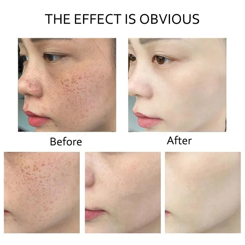 Retinol Serum Anti Wrinkle - Image 4